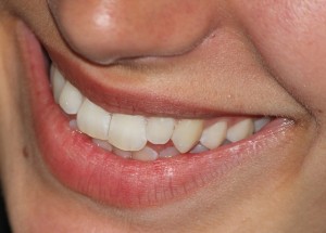 Zdrowe zęby po wizycie u dentysty